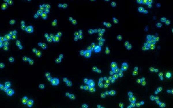 Yeast withstands Mars-like shocks and toxic salts in survival test